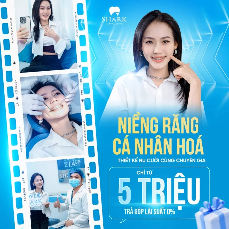 Niềng răng trả góp giúp dân văn phòng quản lý tài chính hiệu quả