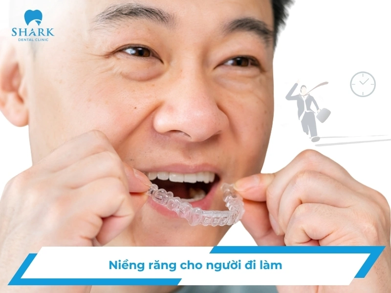 Niềng răng cho người đang đi làm