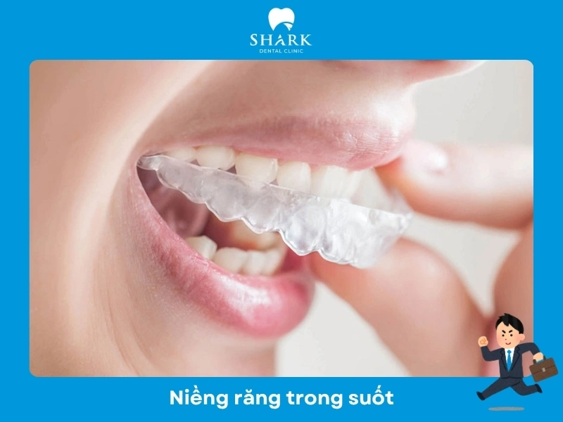Niềng răng trong suốt là giải pháp tốt nhất cho người đi làm