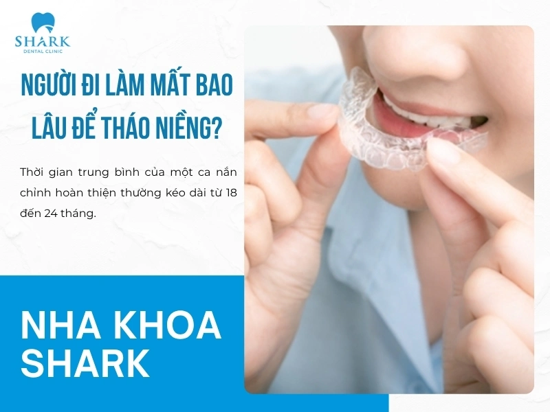 Dân công sở cũng phải tuân thủ thời gian niềng răng như người khác