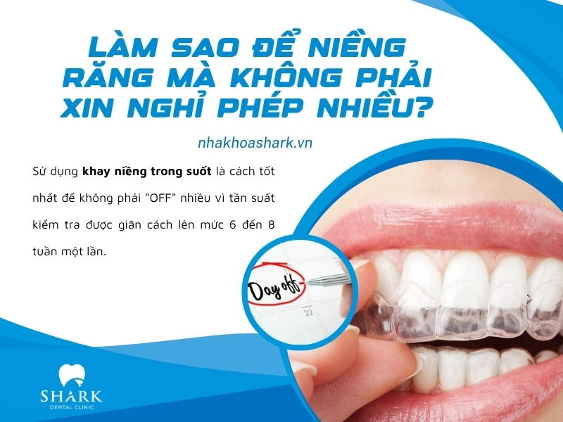Niềng răng trong suốt là giải pháp tốt nhất để không phải đăng ký nghỉ phép nhiều