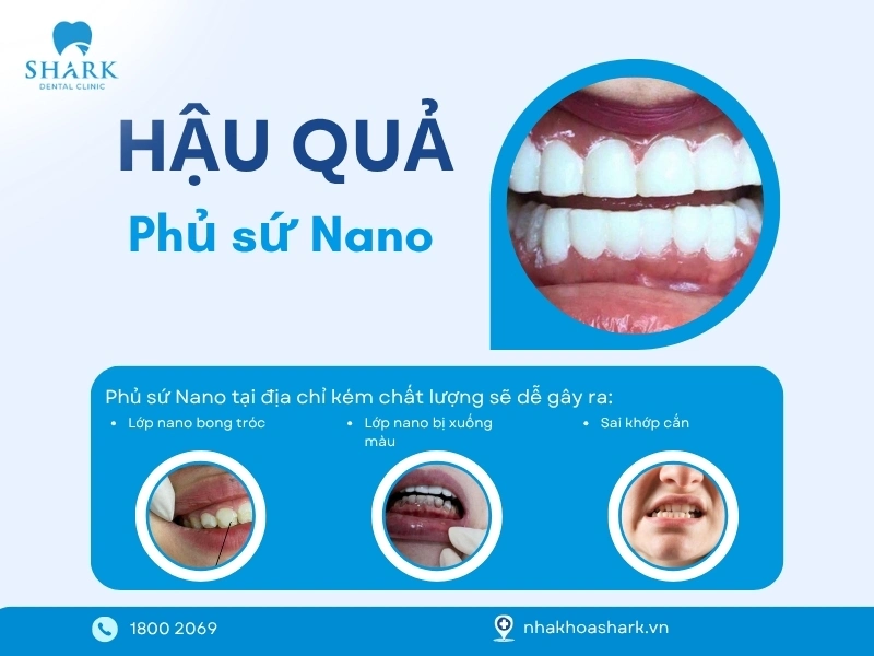 Phủ sứ Nano là gì? Giá bao nhiêu và có tác hại gì không? 8 Các tác hại khi phủ sứ Nano tại địa chỉ kém chất lượng