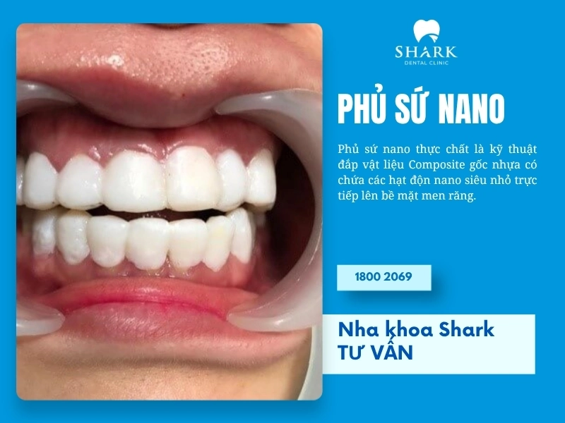 Phủ sứ Nano là gì? Giá bao nhiêu và có tác hại gì không? 7 Phủ sứ Nano