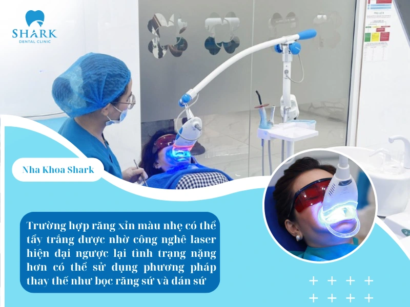 Ở mức độ nhẹ, bác sĩ sẽ chỉ định thực hiện tẩy trắng răng bằng công nghệ Laser giúp hỗ trợ phá vỡ các liên kết gây đổi màu, cải thiện màu sắc răng