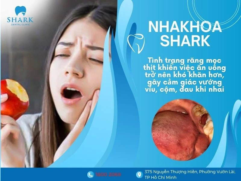 Tình trạng này khiến việc ăn uống trở nên khó khăn hơn, gây cảm giác vướng víu, cộm, đau khi ăn nhai