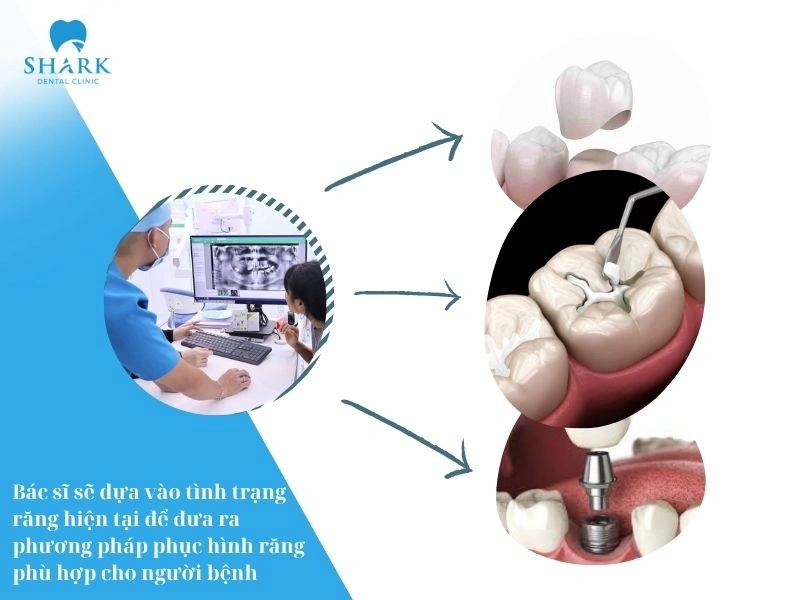 Bác sĩ sẽ dựa vào tình trạng răng còn lại để chọn phương pháp phục hình phù hợp như bọc răng sứ, trám răng,...