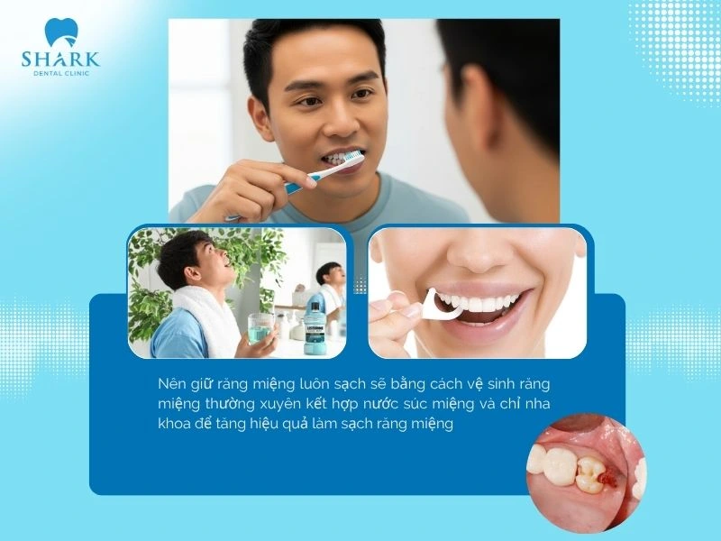 Nên vệ sinh răng miệng thường xuyên kết hợp sử dụng thêm nước súc miệng, chỉ nha khoa để tăng hiệu quả làm sạch