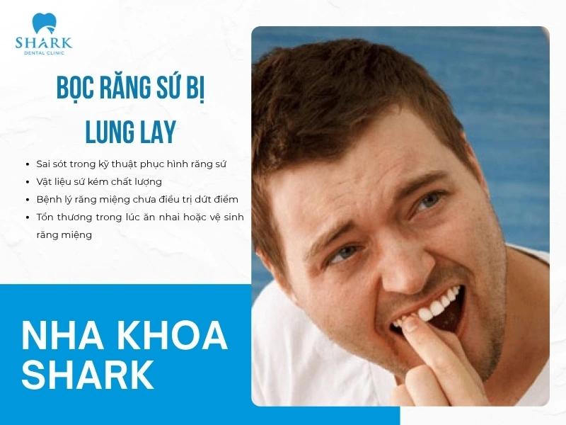 Răng sứ bị lung lay do nhiều nguyên nhân gây ra