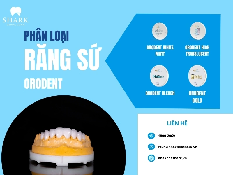 Các loại răng sứ Orodent hiện nay