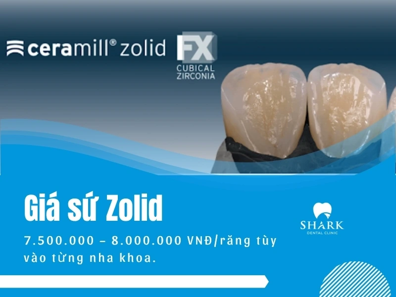 Răng sứ Zolid có tốt không? Quy trình ra sao? 7 Chi phí bọc răng sứ Zolid