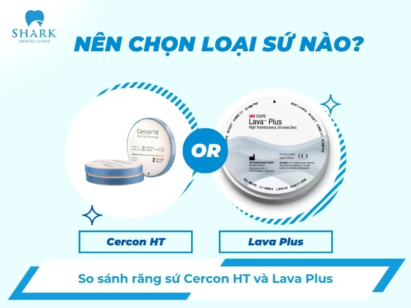 Nên chọn sứ Cercon HT hay Lava Plus