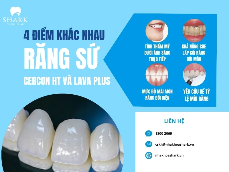 4 điểm khác biệt của 2 loại sứ Cercon HT và Lava Plus