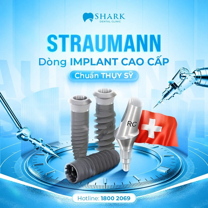 Trụ Straumann được chỉ định dùng tại Nha khoa Shark nhận được đánh giá tích cực từ nhiều khách hàng