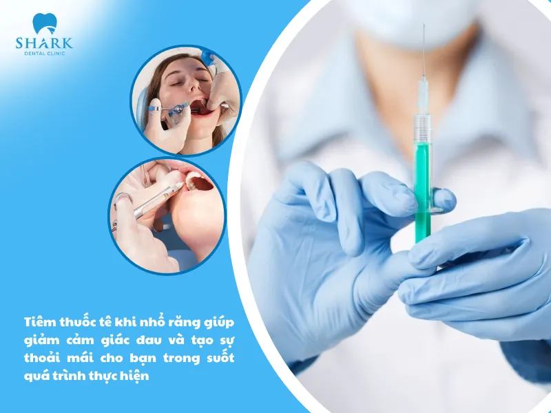 Thuốc tê nhổ răng khôn có ảnh hưởng đến thai nhi không? 6 Tiêm thuốc tê khi nhổ răng giúp giảm cảm giác đau và tạo sự thoải mái cho bạn trong suốt quá trình thực hiện
