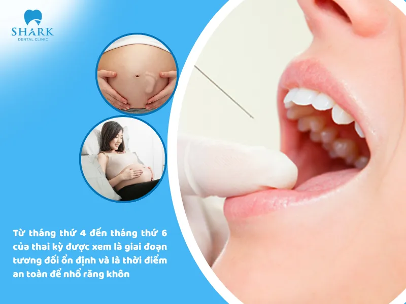 Thuốc tê nhổ răng khôn có ảnh hưởng đến thai nhi không? 10 Từ tháng thứ 4 đến tháng thứ 6 của thai kỳ được xem là giai đoạn tương đối ổn định và là thời điểm an toàn để nhổ răng khôn
