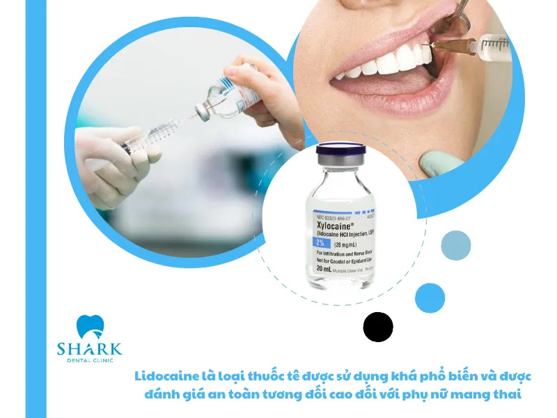 Thuốc tê nhổ răng khôn có ảnh hưởng đến thai nhi không? 8 Lidocaine là loại thuốc tê được sử dụng khá phổ biến và được đánh giá an toàn tương đối cao đối với phụ nữ mang thai