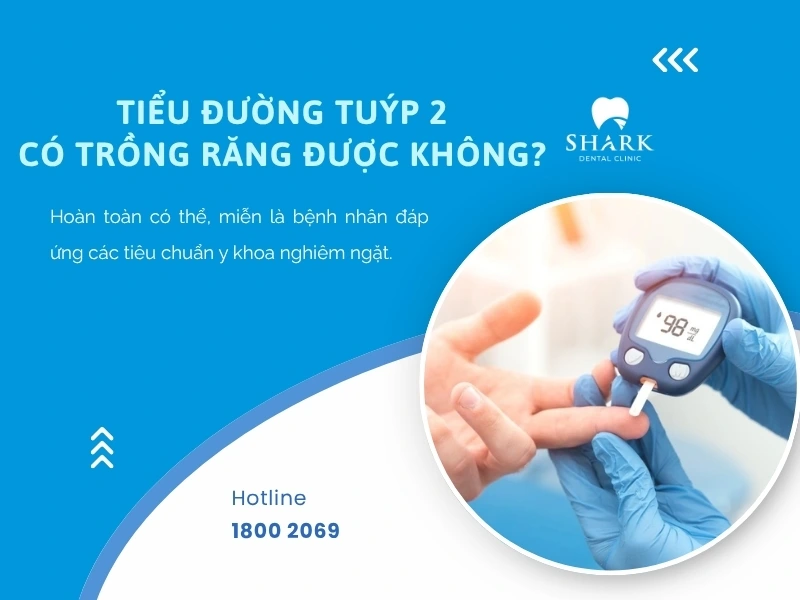 Tiểu đường tuýp 2 có trồng răng Implant được không? 10 Tiểu đường tuýp 2 vẫn trồng răng bình thường nếu kiểm soát tốt tình trạng bệnh lý