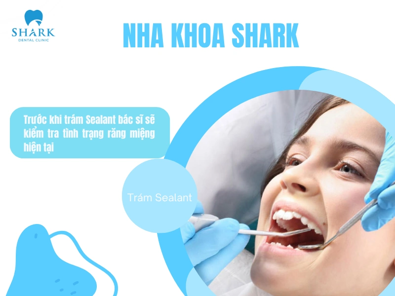Trước khi thực hiện, bác sĩ sẽ thăm khám và kiểm tra tình trạng răng miệng