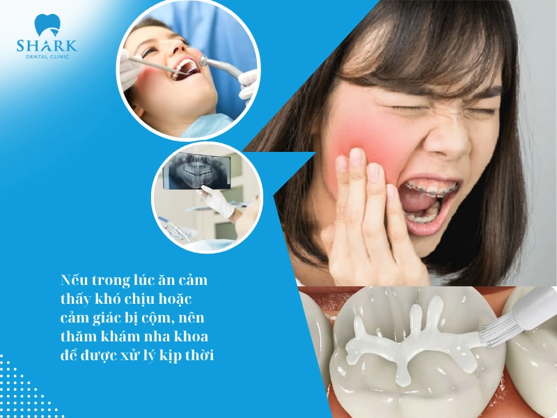 Nếu xuất hiện cảm giác cộm, khó chịu khi ăn nhai, nên thăm khám nha sĩ để được kiểm tra và xử lý kịp thời
