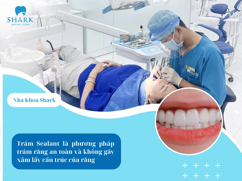 Trám Sealant là phương pháp an toàn và không gây xâm lấn đến cấu trúc răng 