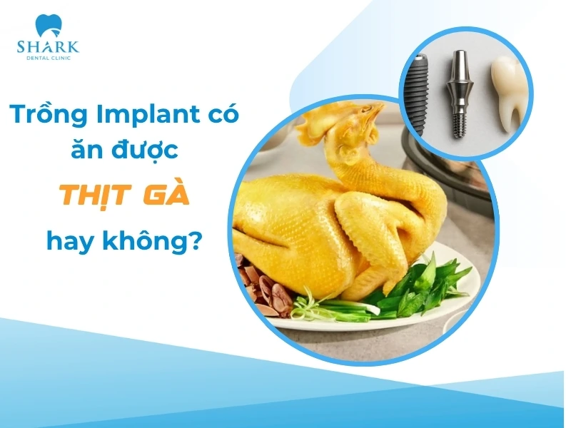 Cấy ghép răng xong có được ăn thịt gà không?