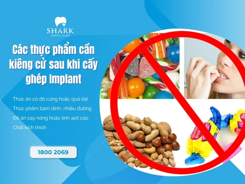 Kiêng cử các thực phẩm theo chỉ định của bác sĩ sau khi trồng răng
