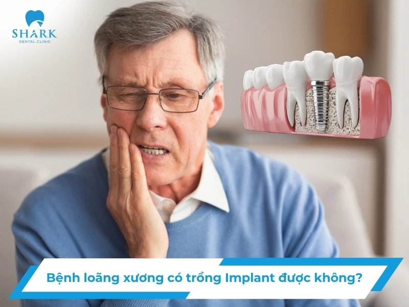 Cấy ghép Implant cho người bị loãng xương có được không? 11 Cấy ghép Implant cho người loãng xương