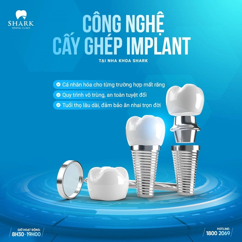 tru-implant-tai-nha-khoa-shark-2