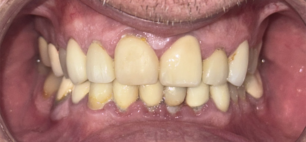 Khách hàng trước thực hiện chính diện