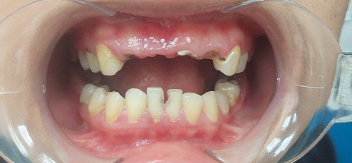 Khách hàng trước thực hiện chính diện