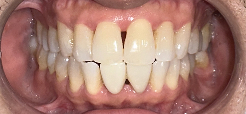 Jeffrey Carlo trước khi điều trị