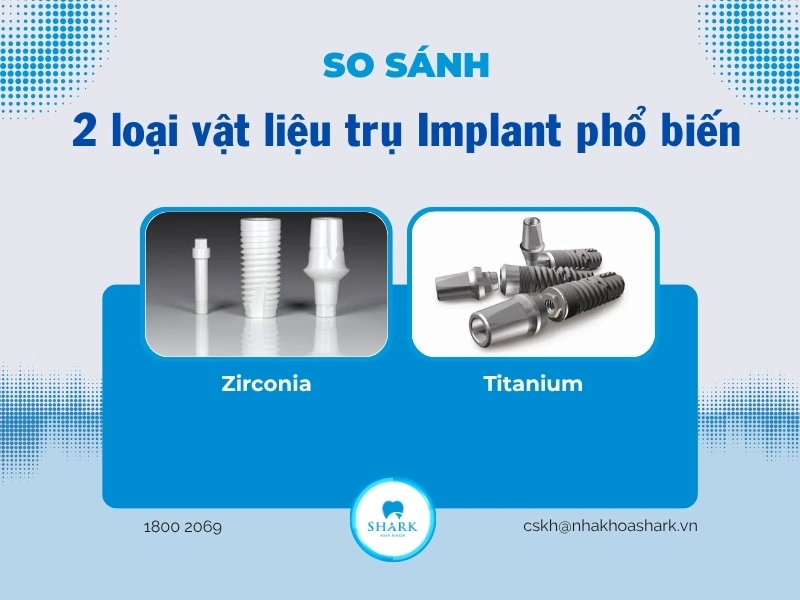 Sự khác biệt giữa 2 trụ Implant sứ và titanium
