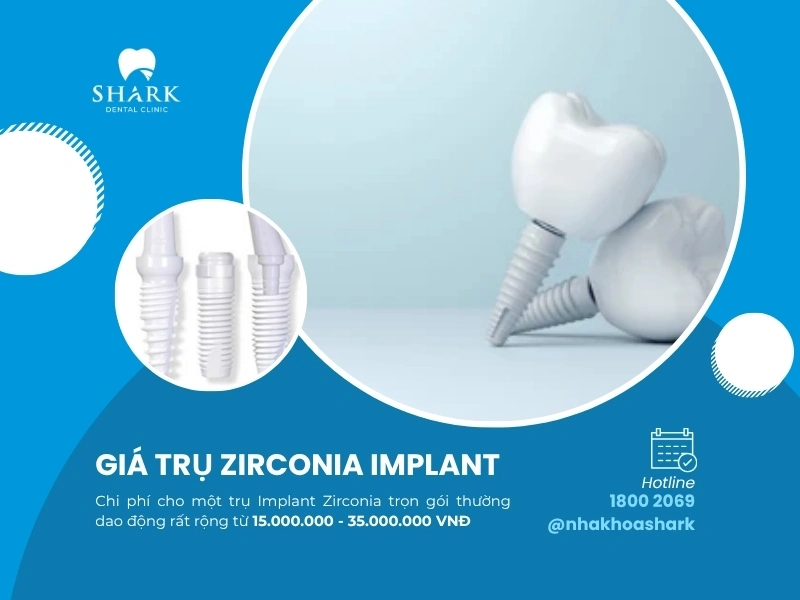 Cấy ghép trụ sứ Implant có giá trên 15.000.000/trụ