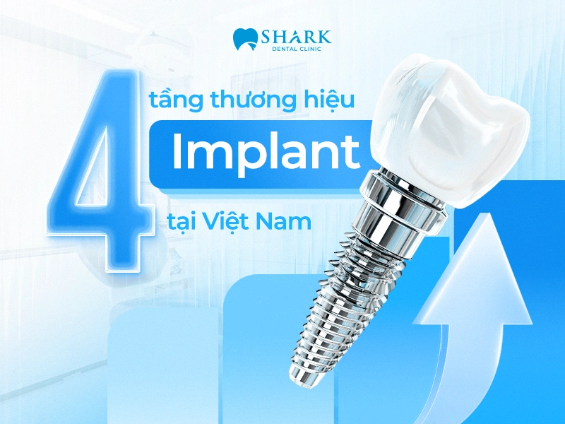 4 tầng thương hiệu Implant tại Việt Nam