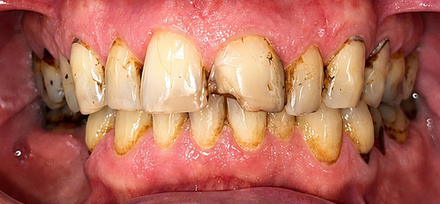 Khách hàng trước thực hiện chính diện