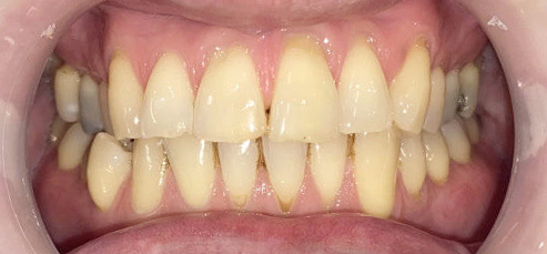 Khách hàng trước thực hiện chính diện