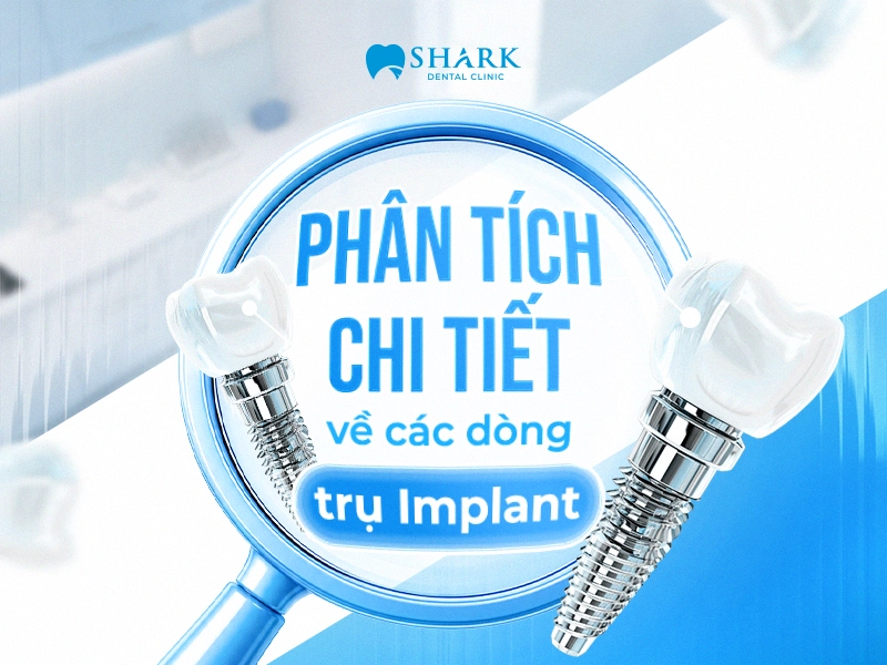 Phân tích chi tiết về các dòng trụ Implant