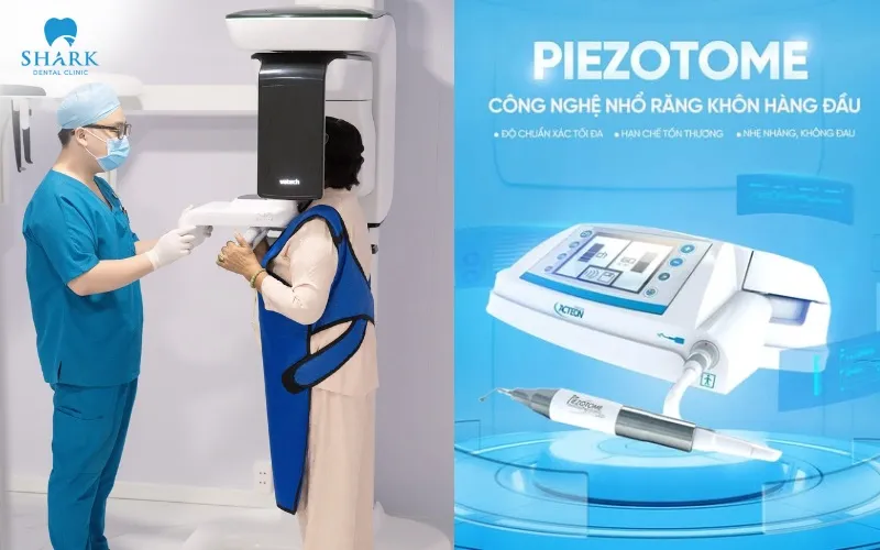Nha khoa Shark ứng dụng công nghệ hiện đại như máy chụp phim ConeBeam CT 3D, máy siêu âm Piezotome giúp đánh giá chính xác cấu trúc xương hàm