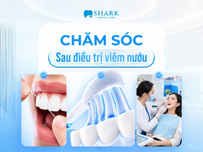 Hướng dẫn chăm sóc sau điều trị viêm nướu