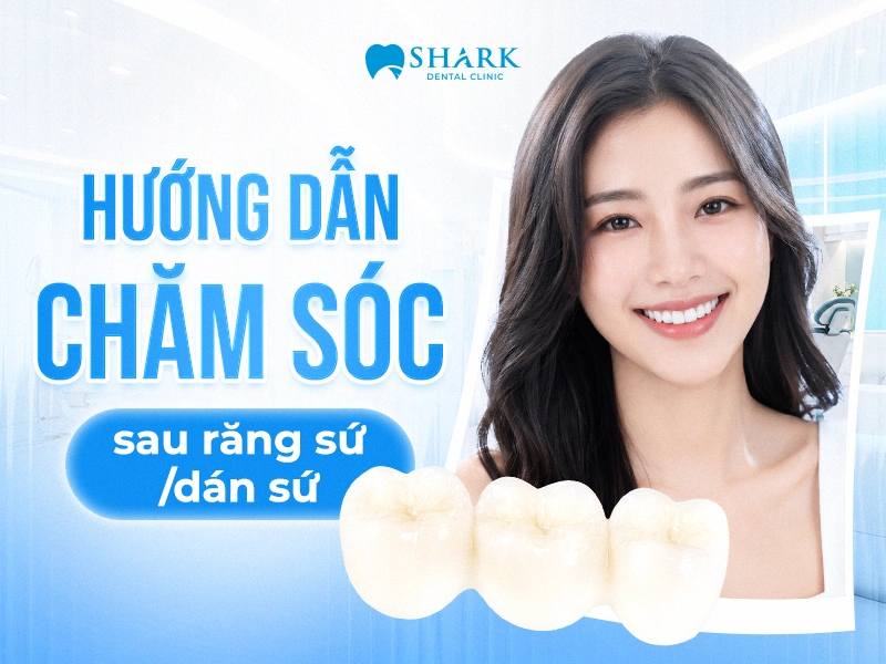 Hướng dẫn chăm sóc sau răng sứ