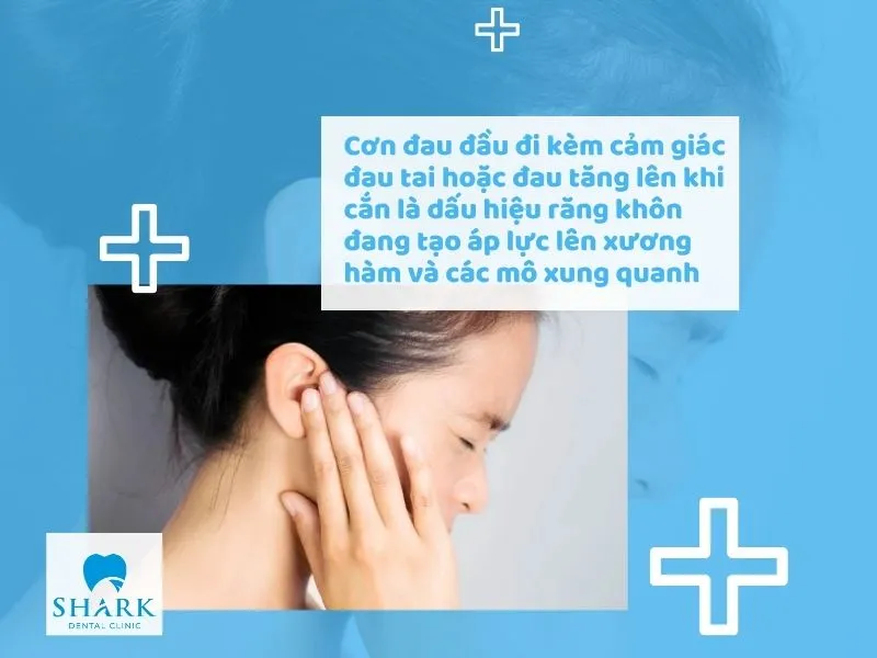 Cơn đau đầu đi kèm cảm giác đau tai hoặc đau tăng lên khi cắn là dấu hiệu răng khôn đang tạo áp lực lên xương hàm và các mô xung quanh