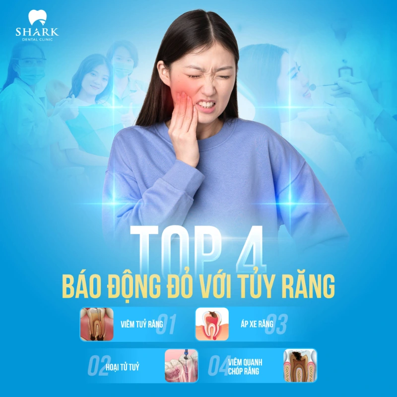 Quy trình lấy tủy răng chuẩn y khoa thực hiện như thế nào? 7 Dấu hiệu nhận biết răng cần lấy tủy răng