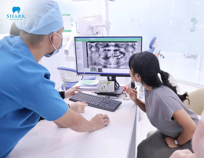 Bọc sứ 4 răng cửa giá bao nhiêu tiền? Bọc loại sứ nào tốt? 4 Làm răng sứ 4 răng cửa