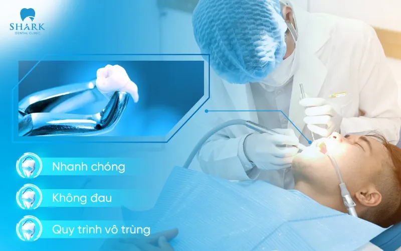 Răng khôn nằm ngang có nên nhổ không? Có nguy hiểm không? 10 Công nghệ siêu âm Piezotome nhổ răng khôn nằm ngang