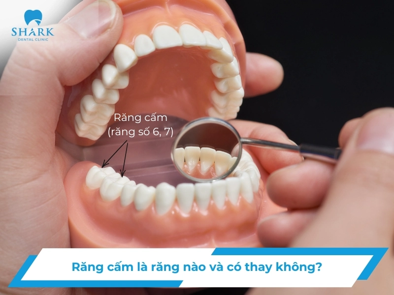 rang cam 1