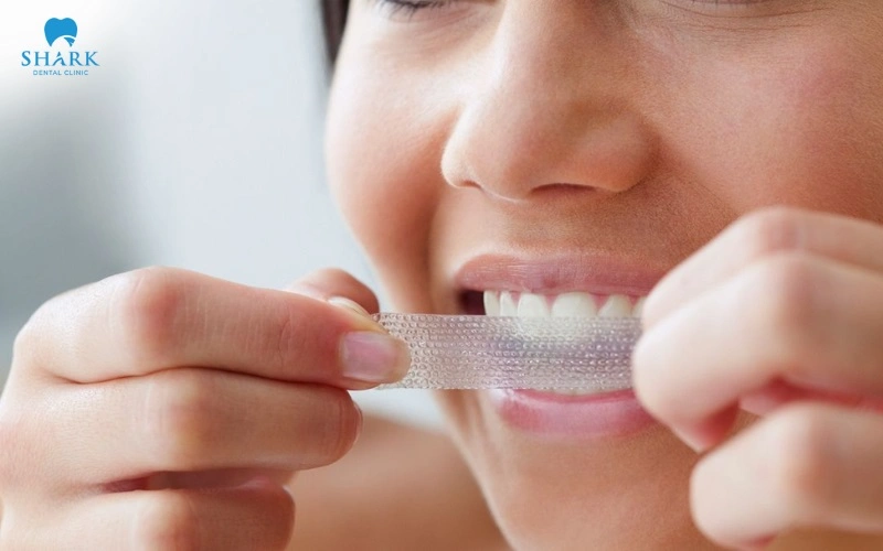 Việc thực hiện tẩy trắng khi răng đang sâu tại nhà không được khuyến khích vì có thể khiến vi khuẩn phát triển mạnh hơn
