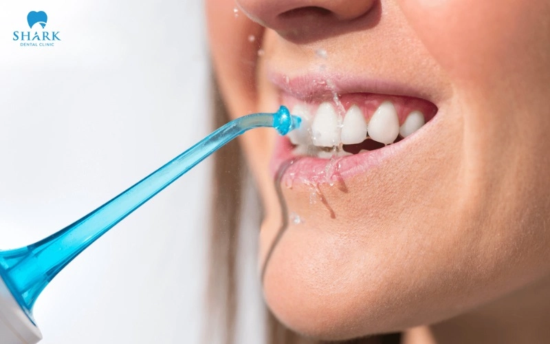 Răng số 5 có thay không? Cách phục hình răng số 5 hiệu quả 11 Vệ sinh răng miệng kỹ lưỡng để bảo vệ răng được tối ưu