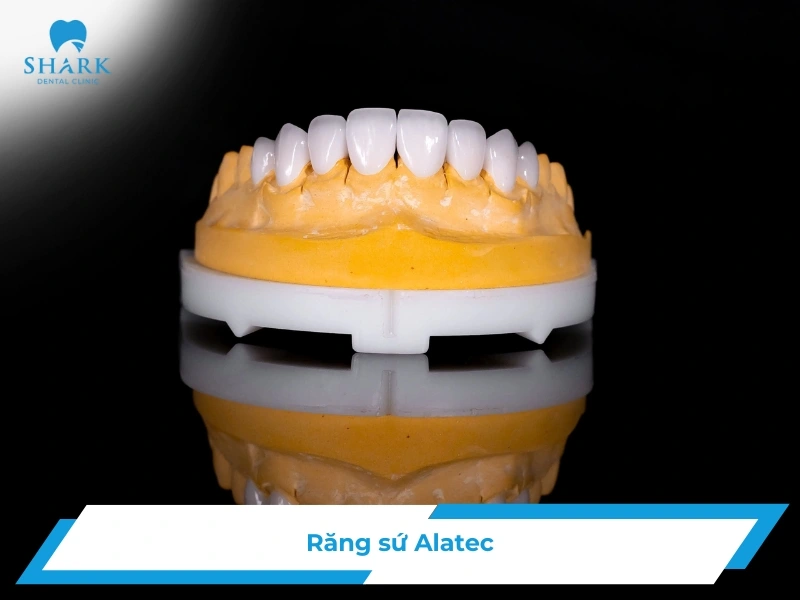 Răng sứ Alatec là gì? Bọc răng sứ Alatec giá bao nhiêu? 7 Răng sứ Alatec