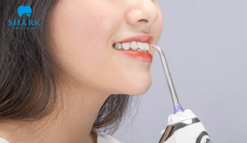 Răng sứ Alatec là gì? Bọc răng sứ Alatec giá bao nhiêu? 7 Hướng dẫn chăm sóc răng sứ tại nhà