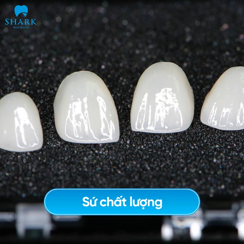 Khách hàng kiểm tra sứ tận mắt tại Shark
